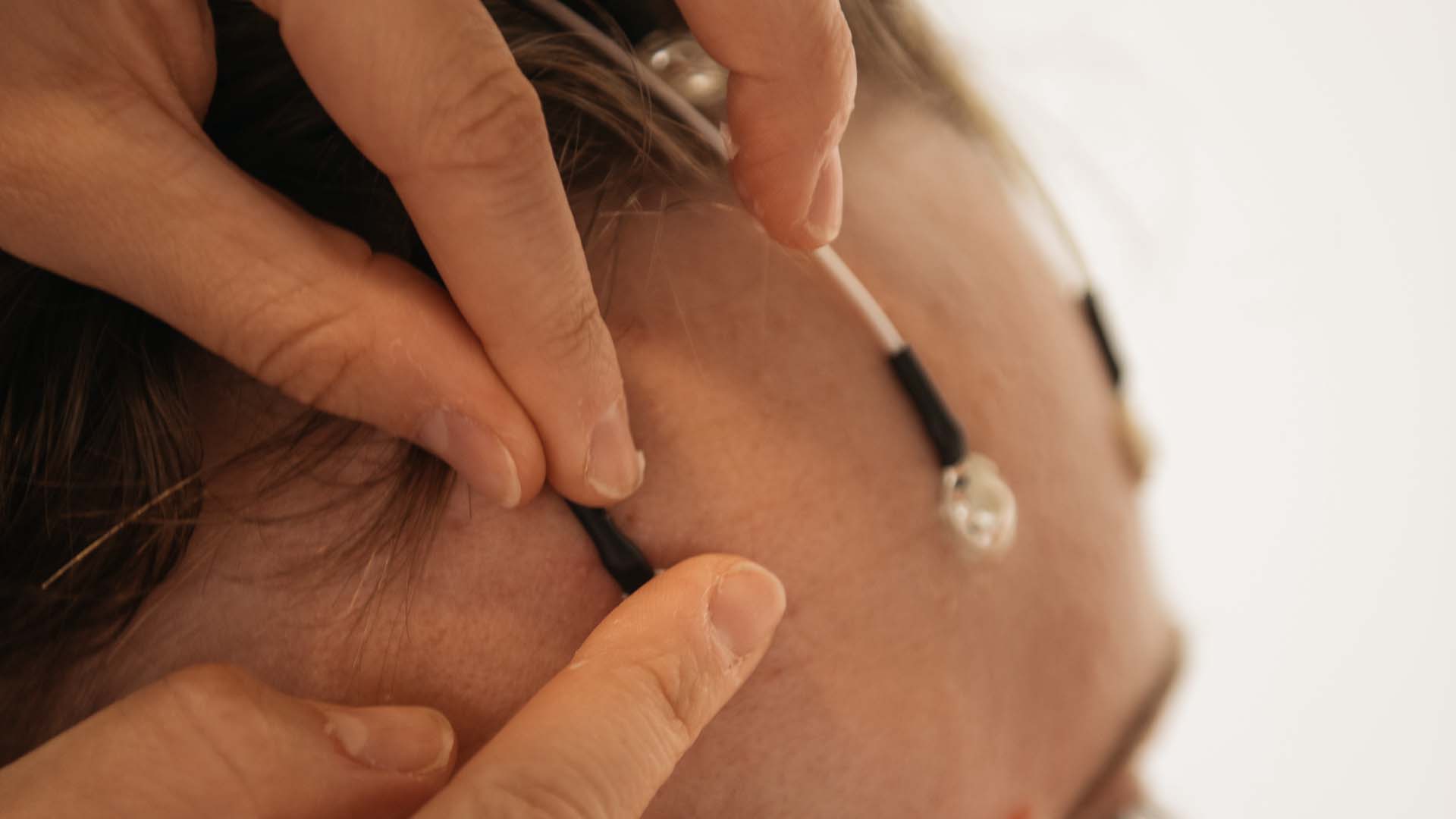 EEG Cup Electrodes Technomed recording